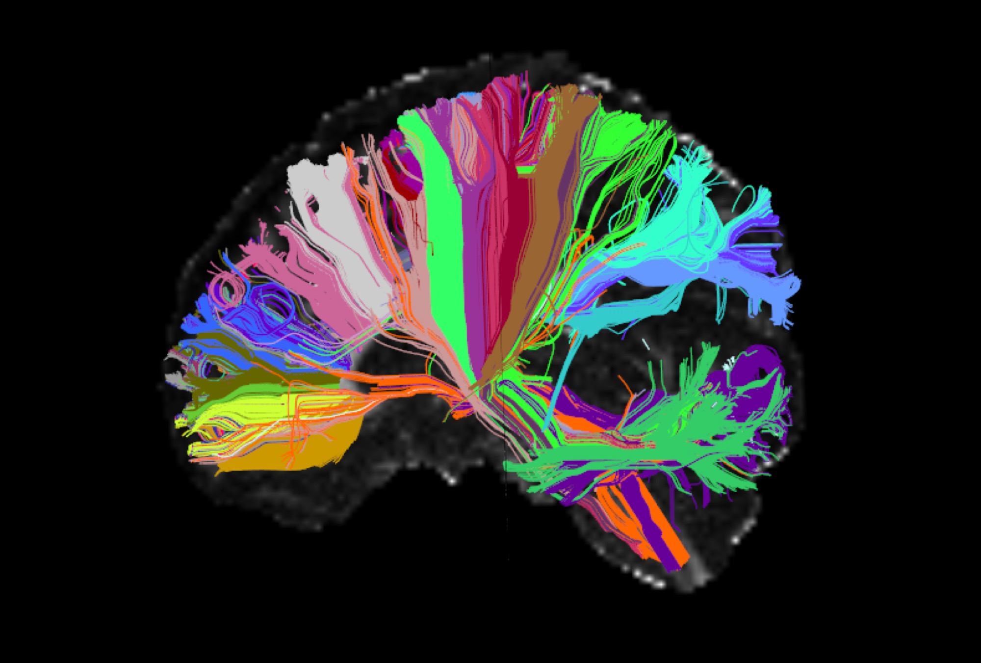 We know very little about the brain: Experts outline challenges in  neuroscience - Scope